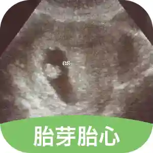 胎芽胎心